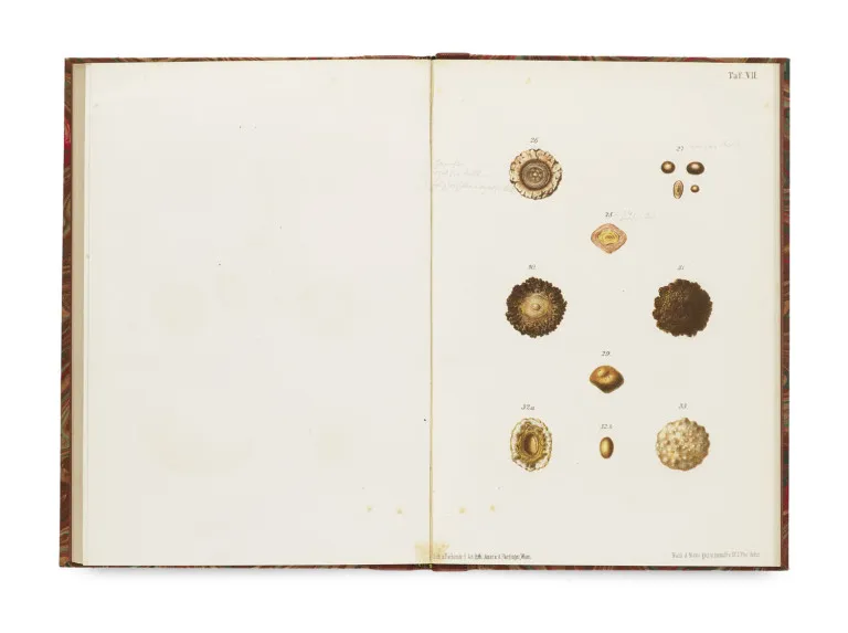 Johann Florian Heller – Les concrétions urinaires, leur formation, détection et analyse...