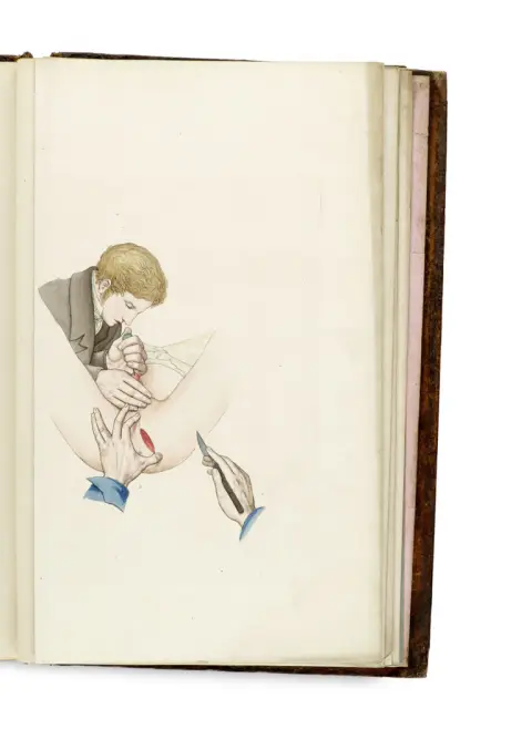 Vincenz von Kern – Les calculs de la vessie, leurs maux associés, et la taille de la pierre chez les deux sexes