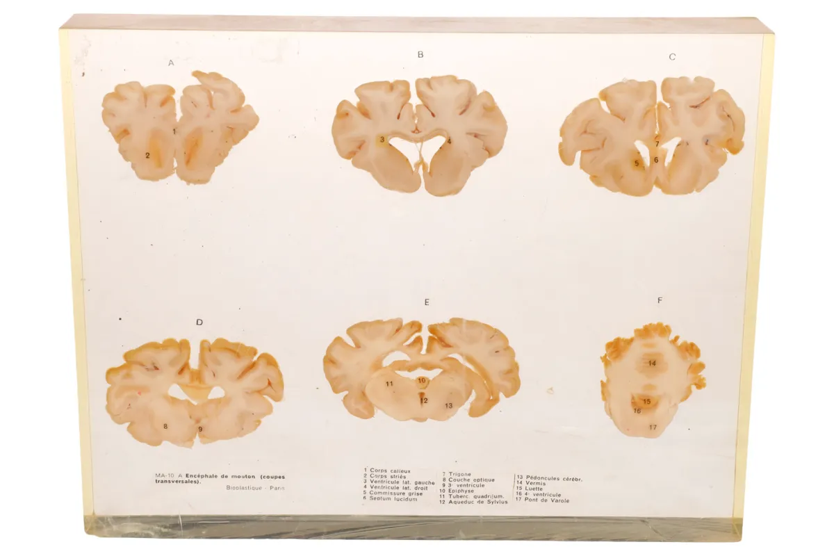 Биологическая модель разреза "Encephale de mouton"