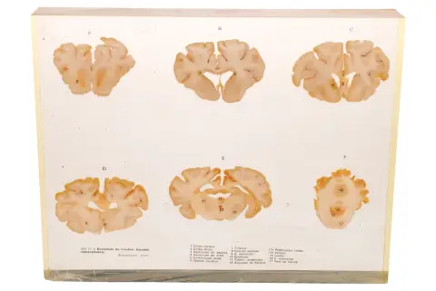 Biologisches Schnittmodell ”Encephale de mouton”