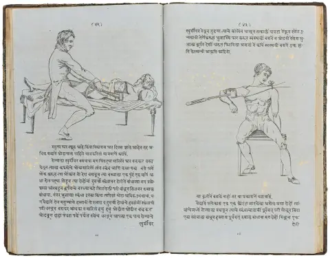 Medicin – McLennan, John. Fractures and Dislocations, oversat (til marathi). Med talrige litograferede tekstillustrationer. Bombay,…