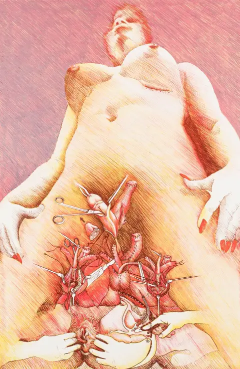 Schlick, Wolfgang – Transplants. 9 värillistä alkuperäistä silkkipainoa, kukin signeerattu, numeroitu ja päivätty. Friedberg, Draier, 1972. 2 lehteä…