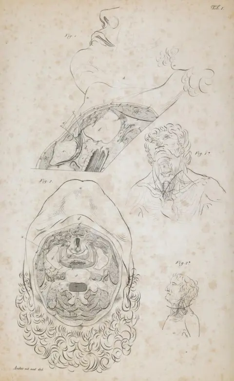 Froriep,R. – Surgical Anatomy of the Ligature Sites on the Human Body